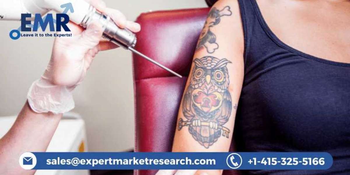 Tattoo Removal Market Share, Size, Growth, Price, Report and Forecast Period Of 2022-2027