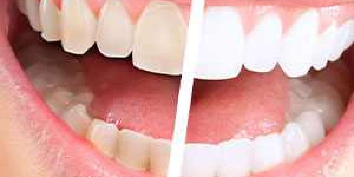 11 Ways to Keep the Teeth Healthy