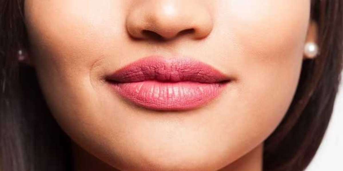 Get Plump-Looking Lips With Lip Augmentation Surgery