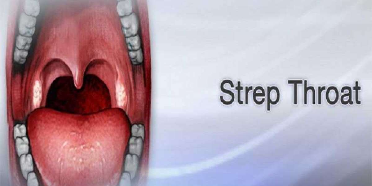 Exploring the Causes: What to Know Before You Try Strep Throat Without Tonsils