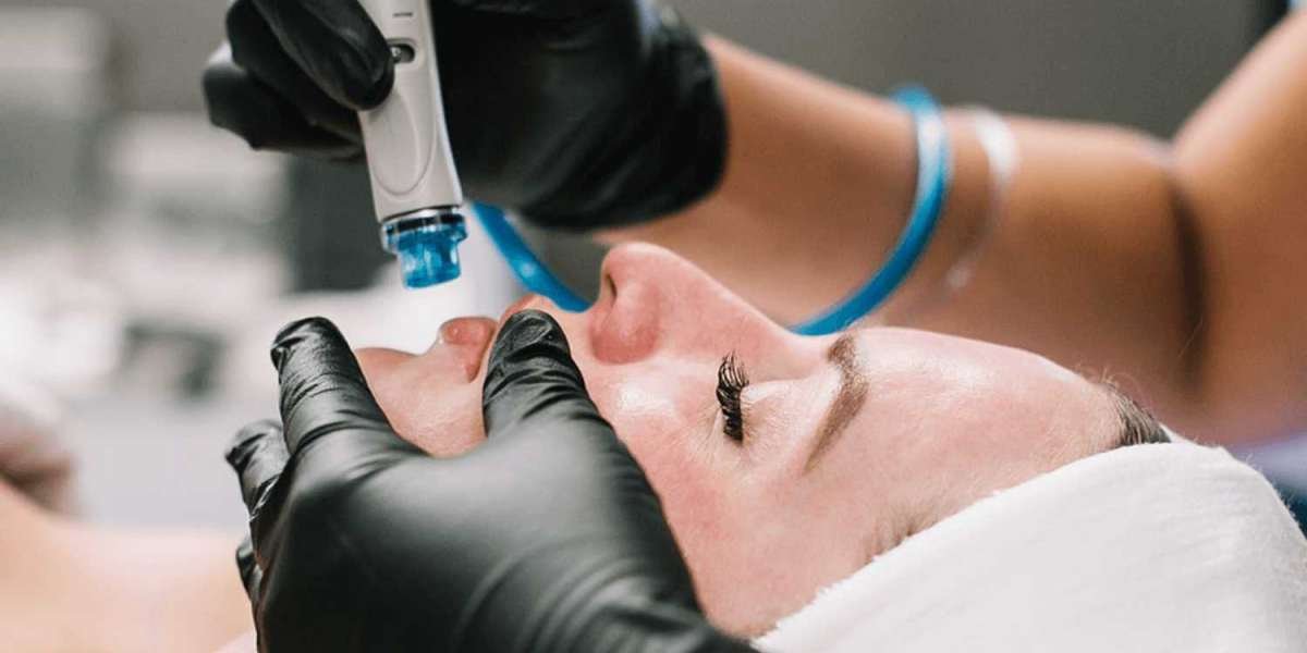 Understanding the Frequency: How Often Should You Get a HydraFacial?