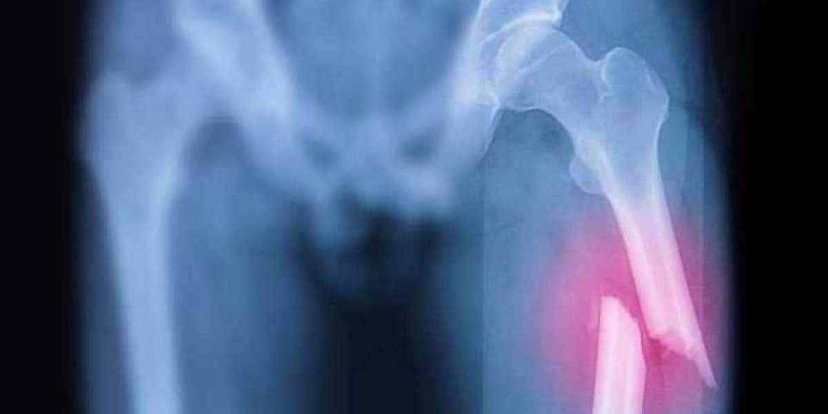 From Aches to Fractures: When to See an Orthopaedic Specialist
